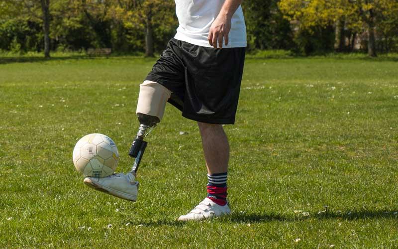 醫療器械加工:假肢CNC加工